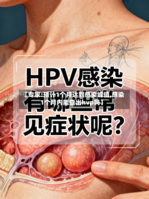 【专家:预计1个月达到感染峰值,感染1个月内能查出hvp吗】